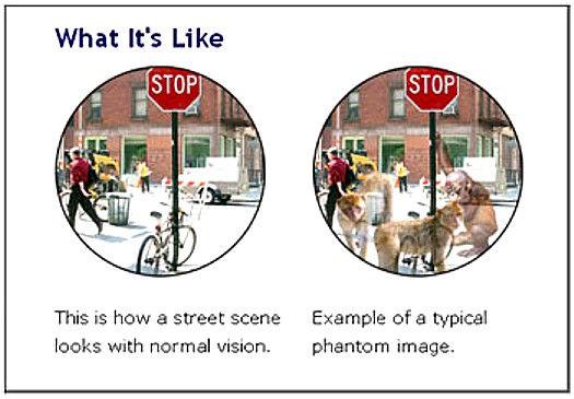 Side by side images with street scene, one without CBS hallucination and one with CBS hallucinations transparent animals and people superimposed over the real street scene.
